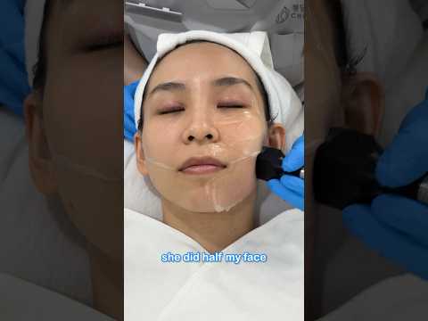 フェイスリフト 施術