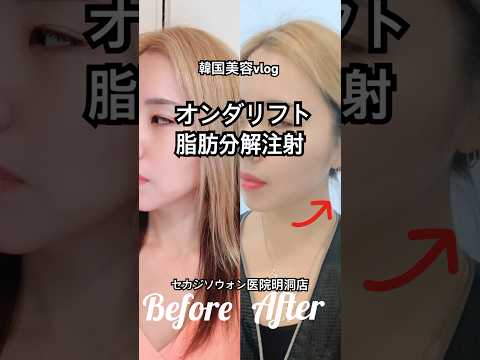 韓国 ONDAボディコンツアリング